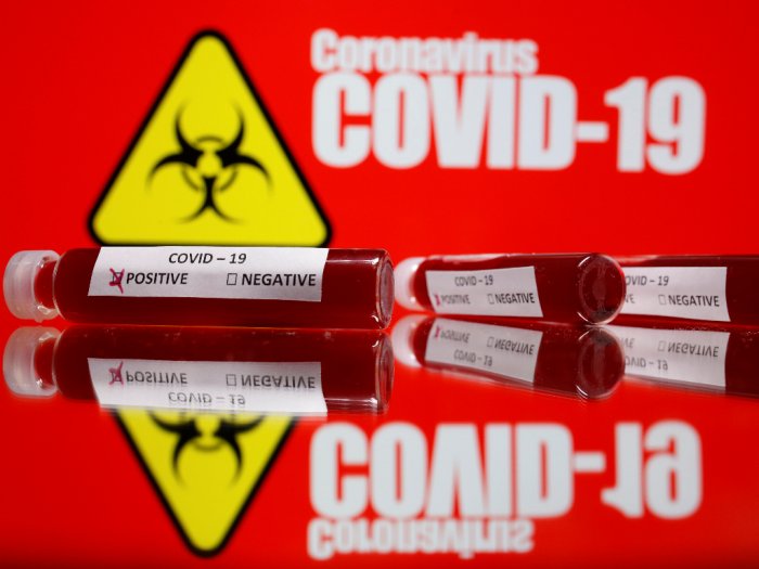Fakta Virus Corona COVID-19 yang Wajib Diketahui